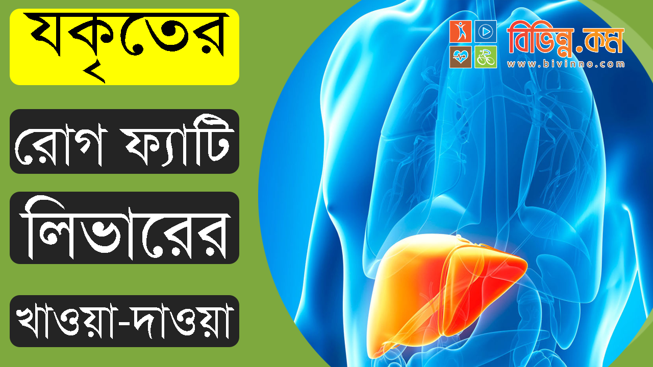 যকৃতের রোগ ফ্যাটি লিভারের খাওয়া-দাওয়া - লিভারের চর্বি কমানোর উপায়