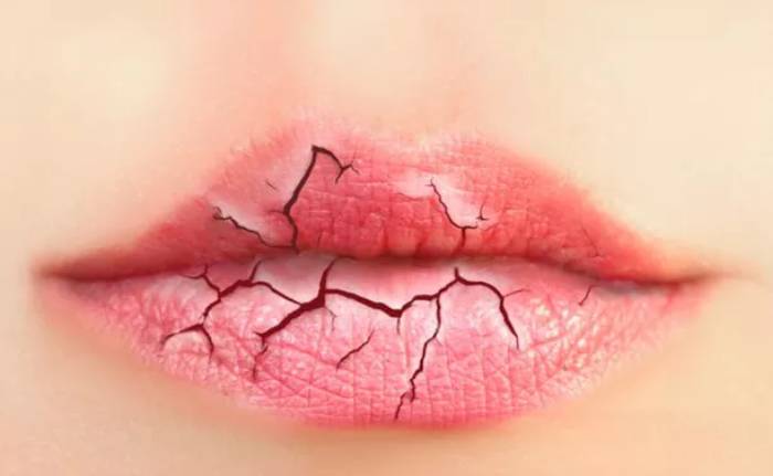 শীত ছাড়াও ঠোঁট শুকিয়ে যে কারণে