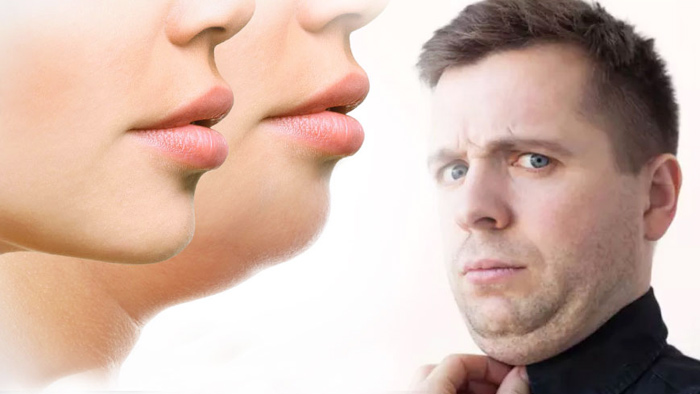 মুখমণ্ডলের মেদ কমানোর উপায় জেনে নিন