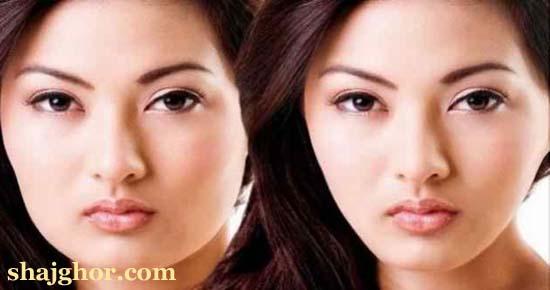 রোদে পোড়া ত্বকের ক্ষতি দ্রুত সেরে তোলার ঘরোয়া উপায়!
