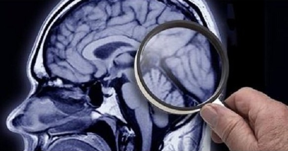 মৃত্যুর পর মস্তিষ্কের কার্যক্ষমতা কতক্ষণ থাকে ?